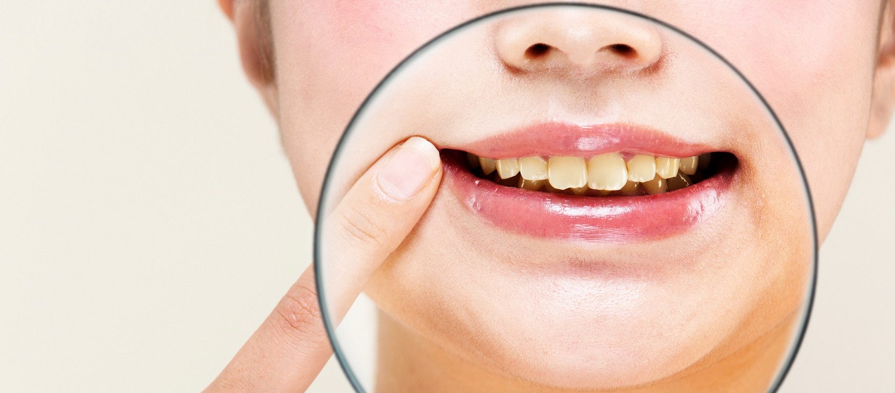  歯の黄ばみ イメージ