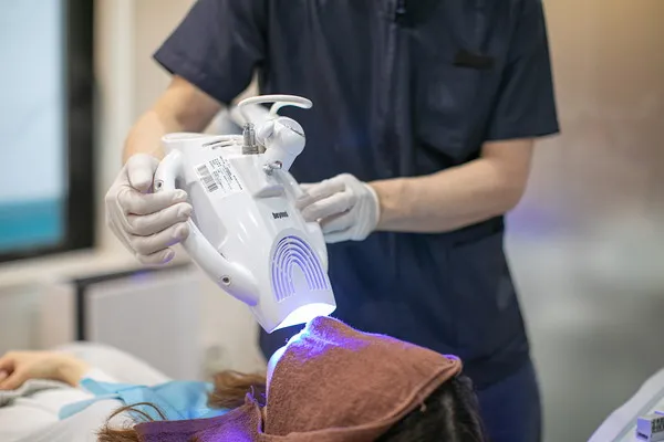 ホワイトニングの照射を行っている様子